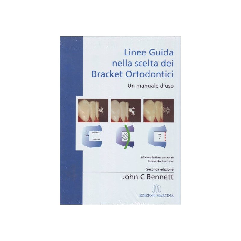 Linee guida nella scelta dei Bracket ortodontici - Un manuale d'uso